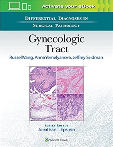 Gynecologic tract [electronic resource]