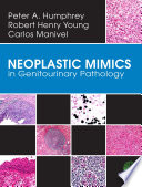 Neoplastic Mimics in Genitourinary Pathology [electronic resource]